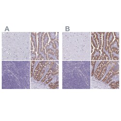 Invitrogen PLCB3 Polyclonal Antibody 100 &mu;L | Buy Online | Invitrogen&trade; | Fisher Scientific