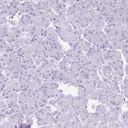 Invitrogen RACGAP1 Polyclonal Antibody 100 &mu;L; Unconjugated:Antibodies,