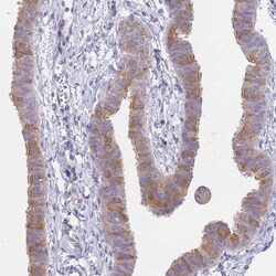 Invitrogen SUGT1 Polyclonal Antibody 100 &mu;L; Unconjugated:Antibodies,