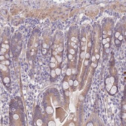 Invitrogen SUGT1 Polyclonal Antibody 100 &mu;L; Unconjugated:Antibodies,