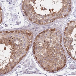 Invitrogen SUGT1 Polyclonal Antibody 100 &mu;L; Unconjugated:Antibodies,