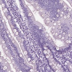 Invitrogen KRT73 Polyclonal Antibody 100 &mu;L; Unconjugated:Antibodies,