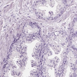 Invitrogen KRT73 Polyclonal Antibody 100 &mu;L; Unconjugated:Antibodies,