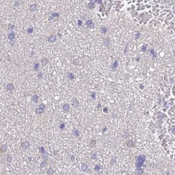 Invitrogen STIP1 Polyclonal Antibody 100 &mu;L; Unconjugated:Antibodies,