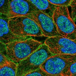 Invitrogen MRP5 Polyclonal Antibody 100 &mu;L; Unconjugated:Antibodies,