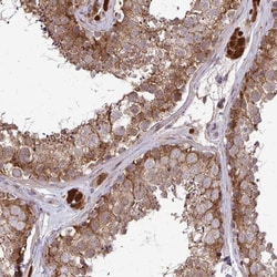 Invitrogen CCS Polyclonal Antibody 100 &mu;L; Unconjugated:Antibodies,