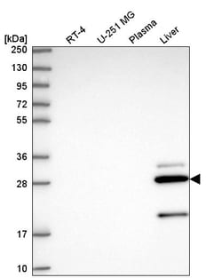 Invitrogen CCS Polyclonal Antibody 100 &mu;L; Unconjugated:Antibodies,
