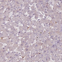 Invitrogen CC2D2B Polyclonal Antibody 100 &mu;L; Unconjugated:Antibodies,