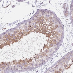 Invitrogen CC2D2B Polyclonal Antibody 100 &mu;L; Unconjugated:Antibodies,