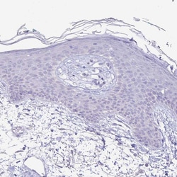 Invitrogen FAH Polyclonal Antibody 100 &mu;L; Unconjugated:Antibodies,
