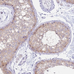 Invitrogen FAH Polyclonal Antibody 100 &mu;L; Unconjugated:Antibodies,