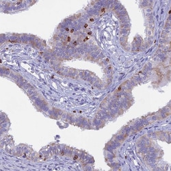 Invitrogen ABI3BP Polyclonal Antibody 100 &mu;L; Unconjugated:Antibodies,