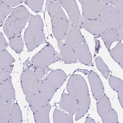 Invitrogen ABI3BP Polyclonal Antibody 100 &mu;L; Unconjugated:Antibodies,