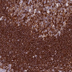 Invitrogen ABI3BP Polyclonal Antibody 100 &mu;L; Unconjugated:Antibodies,