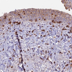 Invitrogen ABI3BP Polyclonal Antibody 100 &mu;L; Unconjugated:Antibodies,