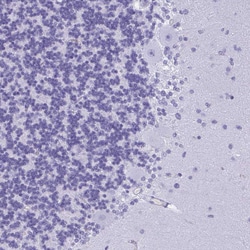 Invitrogen J Chain Polyclonal Antibody 100 &mu;L | Buy Online | Invitrogen&trade; | Fisher Scientific