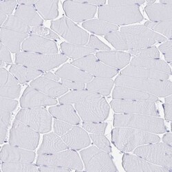 Invitrogen J Chain Polyclonal Antibody 100 &mu;L | Buy Online | Invitrogen&trade; | Fisher Scientific