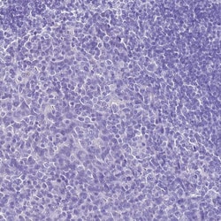 Invitrogen HSP20 Polyclonal Antibody 100 &mu;L | Buy Online | Invitrogen&trade; | Fisher Scientific