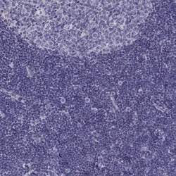 Invitrogen ADAM32 Polyclonal Antibody 100 &mu;L; Unconjugated:Antibodies,