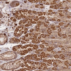 Invitrogen Adenylate Cyclase 9 Polyclonal Antibody 100 &mu;L; Unconjugated:Antibodies,