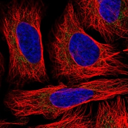 Invitrogen TID1 Polyclonal Antibody 100 &mu;L; Unconjugated:Antibodies,