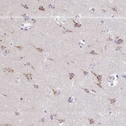 Invitrogen TID1 Polyclonal Antibody 100 &mu;L; Unconjugated:Antibodies,