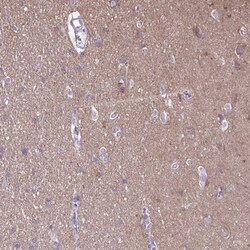 Invitrogen RTN1 Polyclonal Antibody 100 &mu;L | Buy Online | Invitrogen&trade; | Fisher Scientific