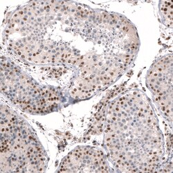 Invitrogen CIC Polyclonal Antibody 100 &mu;L | Buy Online | Invitrogen&trade; | Fisher Scientific