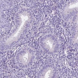 Invitrogen GABRD Polyclonal Antibody 100 &mu;L; Unconjugated:Antibodies,