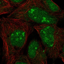 Invitrogen L3MBTL3 Polyclonal Antibody 100 &mu;L; Unconjugated:Antibodies,