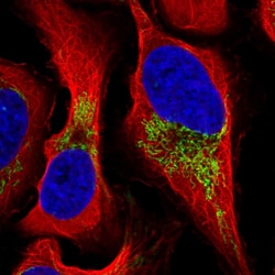 Invitrogen FDXR Polyclonal Antibody 100 &mu;L; Unconjugated:Antibodies,