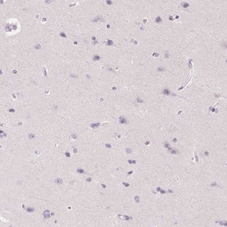 Invitrogen SFTPD Polyclonal Antibody 100 &mu;L; Unconjugated:Antibodies,