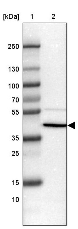 Invitrogen SFTPD Polyclonal Antibody 100 &mu;L; Unconjugated:Antibodies,