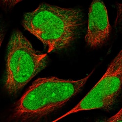 Invitrogen ARL2 Polyclonal Antibody 100 &mu;L; Unconjugated:Antibodies,