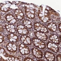 Invitrogen ARL2 Polyclonal Antibody 100 &mu;L; Unconjugated:Antibodies,