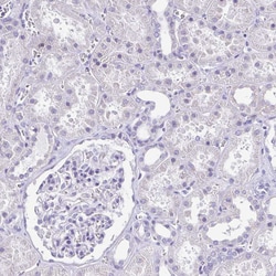 Invitrogen CD72 Polyclonal Antibody 100 &mu;L; Unconjugated:Antibodies,