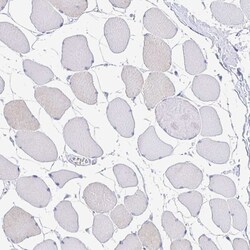 Invitrogen CD72 Polyclonal Antibody 100 &mu;L; Unconjugated:Antibodies,