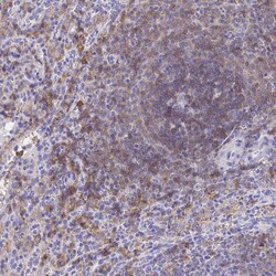 Invitrogen CD72 Polyclonal Antibody 100 &mu;L; Unconjugated:Antibodies,