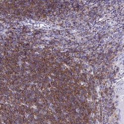 Invitrogen CD72 Polyclonal Antibody 100 &mu;L; Unconjugated:Antibodies,