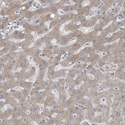 Invitrogen AKR1C4 Polyclonal Antibody 100 &mu;L; Unconjugated:Antibodies,