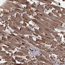 Invitrogen Cardiac Troponin C Polyclonal Antibody 100 &mu;L; Unconjugated:Antibodies,
