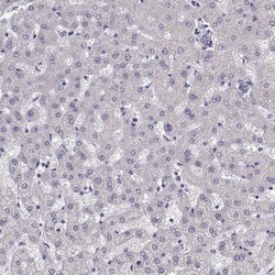 Invitrogen Cardiac Troponin C Polyclonal Antibody 100 &mu;L; Unconjugated:Antibodies,