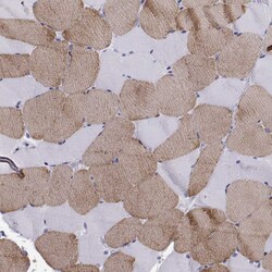 Invitrogen Cardiac Troponin C Polyclonal Antibody 100 &mu;L; Unconjugated:Antibodies,