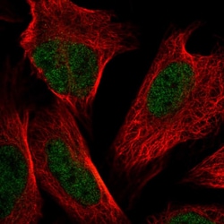Invitrogen NSMCE4A Polyclonal Antibody 100 &mu;L; Unconjugated:Antibodies,