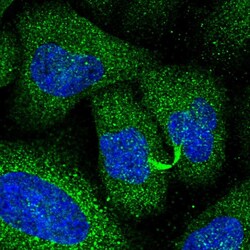 Invitrogen PIK3CD Polyclonal Antibody 100 &mu;L; Unconjugated:Antibodies,