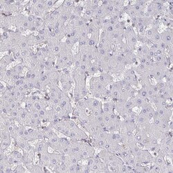 Invitrogen PIK3CD Polyclonal Antibody 100 &mu;L; Unconjugated:Antibodies,