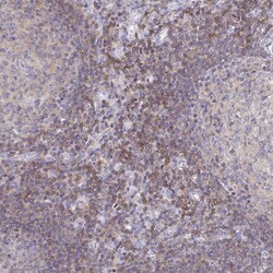 Invitrogen PIK3CD Polyclonal Antibody 100 &mu;L; Unconjugated:Antibodies,
