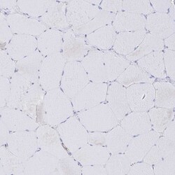 Invitrogen PIK3CD Polyclonal Antibody 100 &mu;L; Unconjugated:Antibodies,