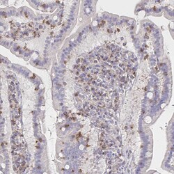 Invitrogen PIK3CD Polyclonal Antibody 100 &mu;L; Unconjugated:Antibodies,