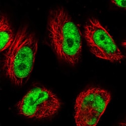 Invitrogen USP22 Polyclonal Antibody 100 &mu;L; Unconjugated:Antibodies,